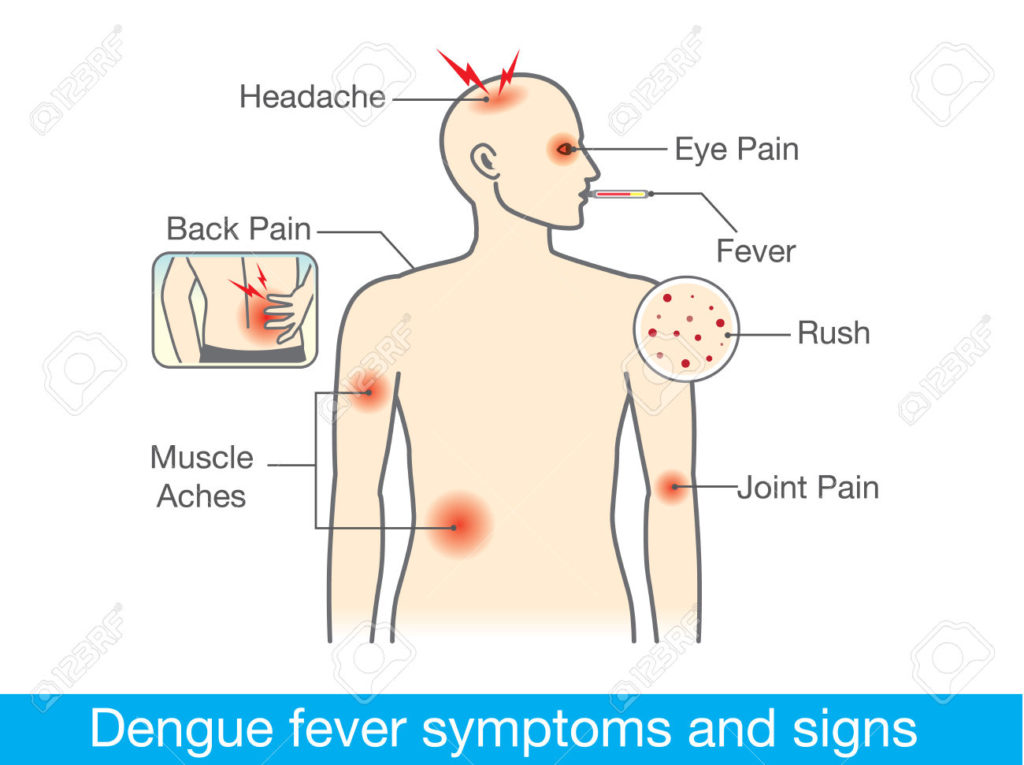 56581739-Diagram-for-health-check-when-have-dengue-fever-symptoms-and-signs--Stock-Vector